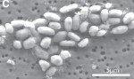 Electron Micrograph of Strain GFAJ-1
